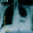 cover: Magla (split)